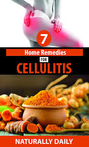 7 Home Remedies For Cellulitis Natural Treatment Home Remedies Natural Home Remedies Remedies
