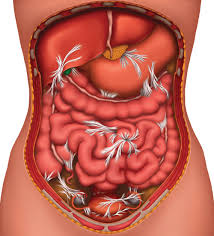 Adhesions Scar Tissue Guide To Adhesions