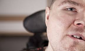 Disability photography: Changing the world one photograph at a time