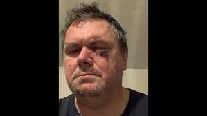 Eishockey Uckermark Verletzung: Fan aus Schwedt schlägt Torwart die Trommel  ins Gesicht