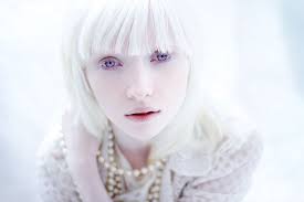 ALBINO ~BEAUTY