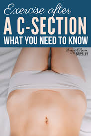 Exercise After A C Section What You Need To Know After C Section Workout C Section Workout Post Partum Workout