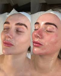 Michelle Amy Chadwick (@michelle_obagiuk) • Instagram photos and videos