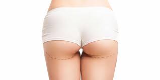 Pour rajeunir ou combler des volumes, le lipofilling, qui consiste à réinjecter au patient sa propre graisse, est devenu l'acte de référence en chirurgie. Chirurgie Des Fesses Paris Dr Th Ktorza