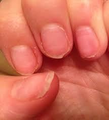 If they're applied properly with good quality products, they will make your nails look strong, healthy and the. Why Your Manicure Could Ruin Your Nails For Life Horror Stories Range From Weeping Sores And Bleeding Nail Beds To Skin Cancer Daily Mail Online