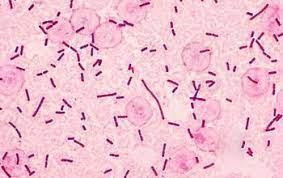 The two species of salmonella are salmonella enterica and salmonella bongori. Salmonella Typhi Salmonella Enterica Subsp Enterica Serovar Typhi