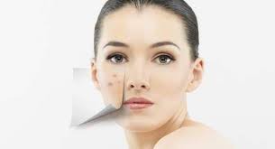 Maybe you would like to learn more about one of these? Cystic Acne Dermatologist Explains How It Can Be Treated Thehealthsite Com