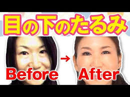 目の下のたるみ 疲れて見える脂肪たるみを改善 眼輪筋ストレッチ 顔ダンス アラ還 おきゃんママ 加藤ひとみ youtube フェイスケア 目の下 顔のエクササイズ