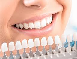 Zoom Teeth Whitening in Tustin | Get a Brighter Smile Today