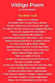 Vitiligo Poem By Kinjal Sanghavi She Is A Vitiligo Warrior