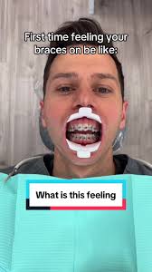 Adjusting to Braces: Tips for a Smooth Transition