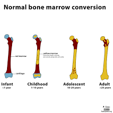 Marrow Conversion Throughout Development Occurs In A Predictable Pattern And Should Not Be Confused With Pathology Th Radiology Bone Marrow Yellow Bone Marrow