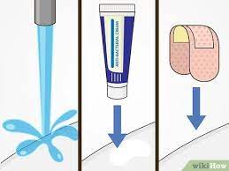 You tend to try to take advantage of it before it gets blazing hot! 3 Ways To Remove Cactus Needles Wikihow
