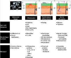 a comprehensive pathophysiology of dandruff and seborrheic