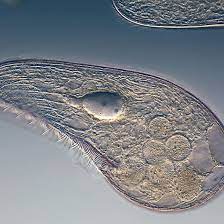 Pond water critters you can see with a microscope. Types Of Bacteria Microorganisms In Pond Water With Pictures Pond Informer