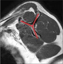 Image result for Shoulder Imaging