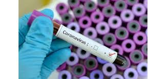 From latin antidotum, from ancient greek ἀντίδοτον (antídoton), neuter of ἀντίδοτος (antídotos, given as a remedy for), from ἀντιδίδωμι (antidídōmi, i give in return, repay), from ἀντί (antí, against) + δίδωμι (dídōmi, i give). Covid 19 Breakthrough Australian Researchers Find Antidote Hospibuz