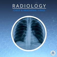Image result for Chest XRay Interpretation