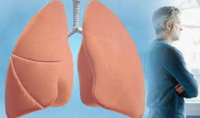 If you're experiencing new or unusual symptoms, tell your doctor right away. Lung Cancer Every Heartbreaking Stage Of The Deadly Disease Express Co Uk