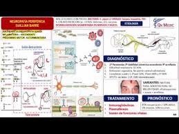 It can lead to paralysis, which is usually temporary. Neurologia Sindrome De Guillian Barre Youtube