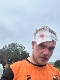 🧡 Six point Saturday 🖤2 trips to A and E 🧡 a father and son debut 🖤2  bloody shirts to clean Never a dull moment for the rovers!!!