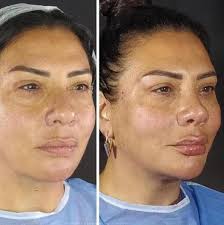 Işın Karaca'dan 'file dönmüşsün' diyen takipçisine çamaşır suyu önerisi