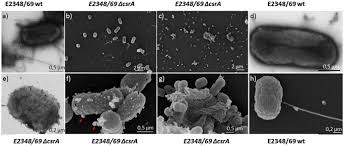 Coli — модельный организм без недостатков. Metabolome And Transcriptome Wide Effects Of The Carbon Storage Regulator A In Enteropathogenic Escherichia Coli Scientific Reports
