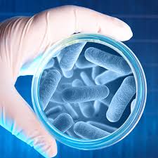 Image result for Legionella