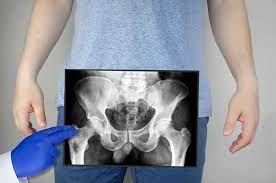 Senaman juga menguatkan tulang pinggul. Mengenal Anatomi Panggul Manusia Dan Penyakit Terkait Panggul Alodokter