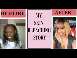 What can i use jolen creme bleach for? Pin By Monique Fenderson On Makeup Skin Bleaching Skin Bleaching Cream Bleaching Your Skin