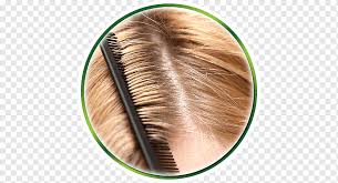 Jika kulit kepala gatal, berkerak, banyak bercak atau berdarah ketika digaruk, bisa jadi terkena penyakit psoriasis. Panduan Selangkah Demi Selangkah Untuk Mengatasi Ketombe Secara Alami Kerontokan Rambut Masalah Kulit Sikat Rambut Kulit Kepala Png Pngwing