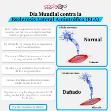 En la ela, las células nerviosas (neuronas) motoras se desgastan o mueren y ya no pueden enviar mensajes a los músculos. Gljrvqtbh5fjsm