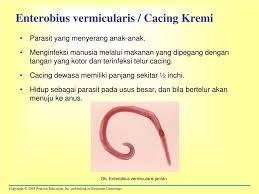 Gambar 2.1 cacing kremi (enterobius vermicularis)14 manusia terinfeksi bila menelan telur infektif, telur akan menetas di dalam usus (daerah sekam), dan kemudian akan berkembang menjadi dewasa. 100 Gambar Cacing Dewasa Enterobius Vermicularis Paling Hist Gambar Pixabay