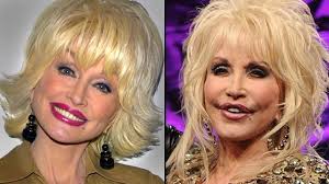 Chatter Busy Dolly Parton Facelift Celebrity Surgery Dolly Parton Plastic Surgery Celebrity Plastic Surgery