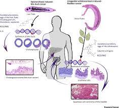 Why Does Infection With Some Helminths Cause Cancer Trends In Cancer