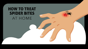 Image result for Spider Bite