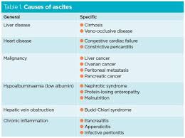 Ascites Symptoms Causes Treatment Nursing Times