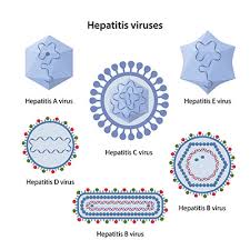 Hev is a common cause of hepatitis outbreaks in developing parts of the world and is increasingly recognized as an important cause of disease in developed countries. Hepatitis A Virus Infektion Ubertragung Krankheiten Medlexi De
