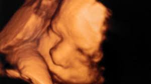 Florida Pro-Abortion Group Pays $186,000 in Campaign Fraud Case