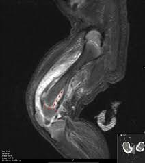 A Radical Switch In Clonality Reveals A Stem Cell Niche In The Epiphyseal  Growth Plate | Nature