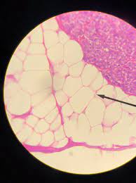 Adipose Tissue Adipose Tissue Loose Connective Tissue Adipose