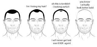 What are the signs of balding? Signs And Symptoms Of Hair Loss Male Pattern Baldness Pattern Baldness Body Hair Loss