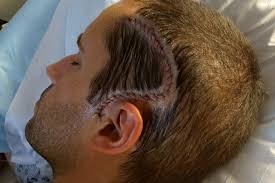 Fundraiser for Christopher Schott by Melisa Zimmerman : Give Chris A Shot  to Beat Brain Cancer