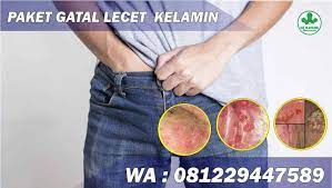 Check spelling or type a new query. Salep Untuk Gatal Lecet Bintik Merah Di Lubang Miss V De Nature Original