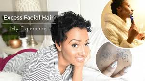 Female facial hair or hirsutism is more common after menopause. Excess Facial Hair In Women Causes Treatments My Experience Youtube