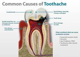 Pin On Dental Knowledge