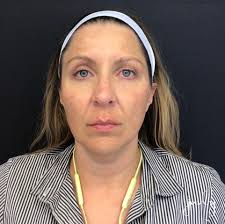 Juvly Aesthetics added a new photo.