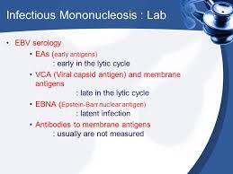Mono is a viral infection that causes symptoms like fatigue, swollen lymph nodes, and a severe sore throat. Infectious Mononucleosis Ppt Video Online Download
