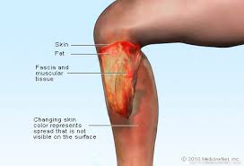 These names are derived from latin. Leg Picture Image On Medicinenet Com