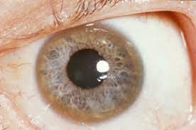 Copper Toxicity Wikipedia